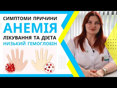 Видео: Анемія: симптоми, ознаки і лікування. Залізодефіцитна анемія. Низький гемоглобін та дефіцит заліза