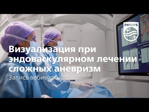 Видео: Визуализация при эндоваскулярном лечении сложных аневризм