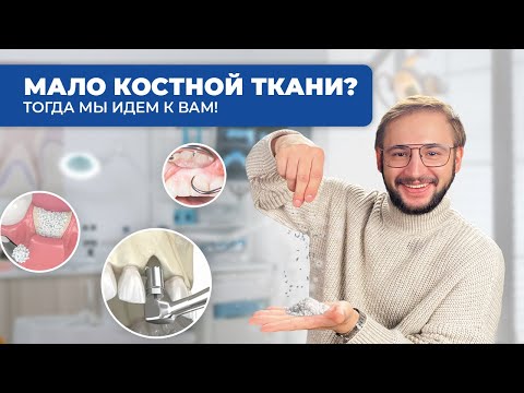 Видео: Костная пластика: все, что нужно знать!