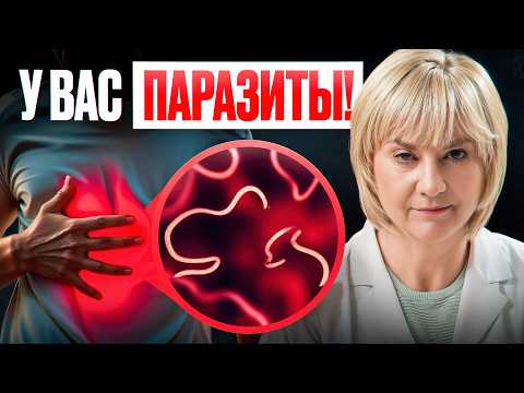 Видео: Как понять, что у тебя паразиты? Не игнорируй эти симптомы