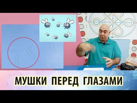 Видео: Мушки в глазах. Почему они появляются и как от них избавиться