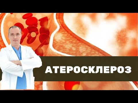 Видео: ❤ Что такое атеросклероз на самом деле?