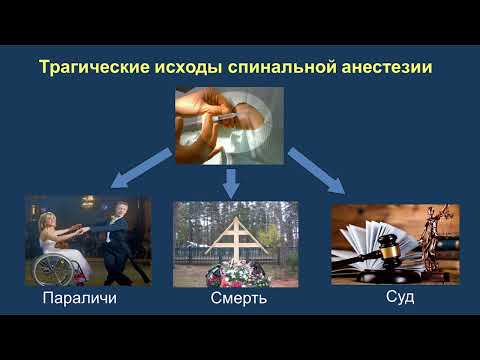 Видео: Спинальная анестезия