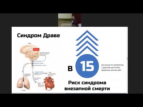 Видео: Синдром Драве