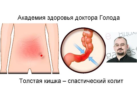 Видео: Толстая кишка. Спастический колит.