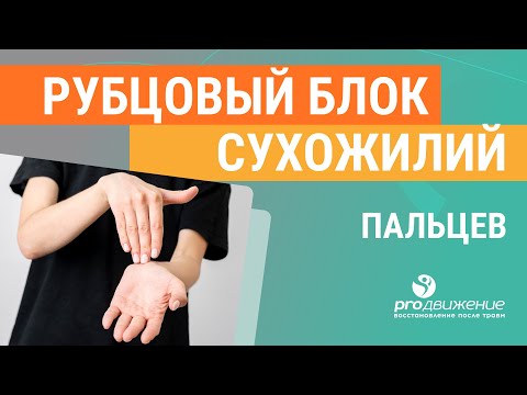 Видео: Рубцовый блок сухожилий пальцев ✋