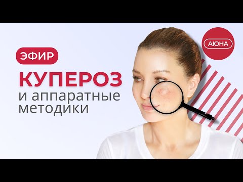 Видео: Купероз и аппаратные методики