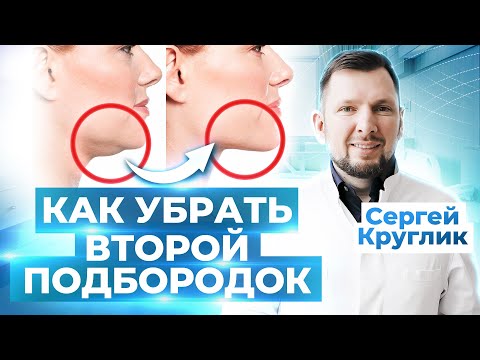 Видео: КАК УБРАТЬ ВТОРОЙ ПОДБОРОДОК: хирургические и косметологические способы