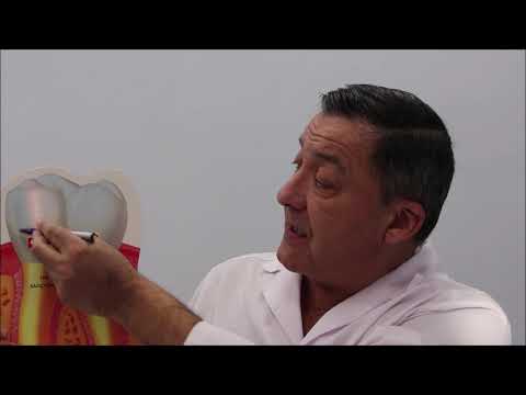 Видео: Почему не надо удалять зуб