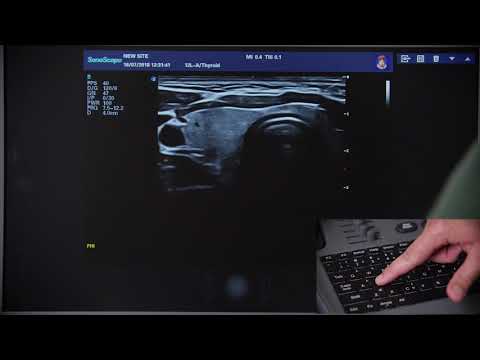 Видео: S40Exp 3 Настройки B режима