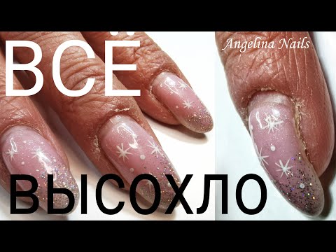 Видео: ВСЕ СУХОЕ / истончение боковых стенок ногтя / точка вроста в синусах / кто виноват в этом  ???
