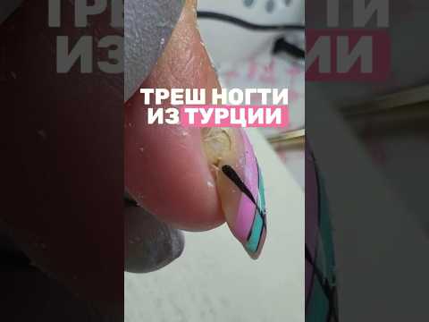 Видео: Треш маникюр из Турции #трешманикюр #трэш #nails #маникюр #ногти #трэшконтент