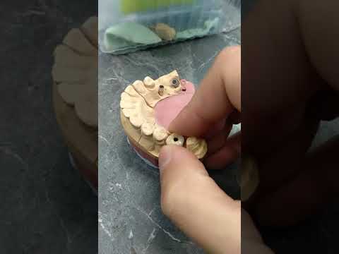 Видео: Обработка лазерных каркасов, винтовая фиксация