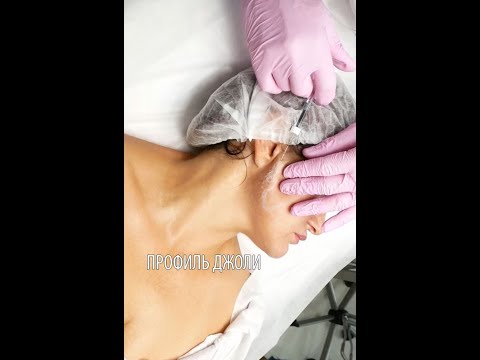 Видео: ПРОФИЛЬ ДЖОЛИ