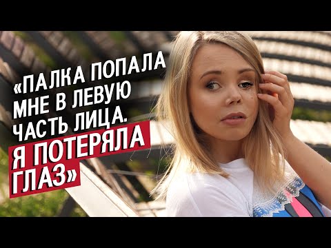 Видео: После ДТП мне заново собрали лицо: Оксана | Быть молодым