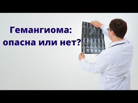 Видео: Гемангиома: опасна или нет?