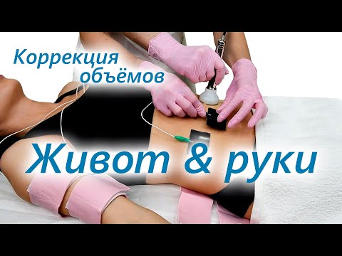 Видео: Коррекция дряблой кожи рук и объёмов живота
