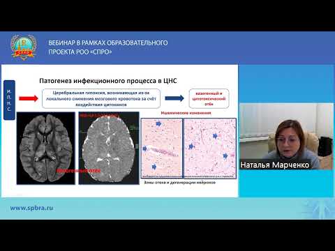 Видео: ВЕБИНАР «НЕЙРОРАДИОЛОГИЯ В ПЕДИАТРИЧЕСКОЙ ПРАКТИКЕ»