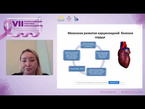 Видео: Иванова А.К. | Карциноидное сердце
