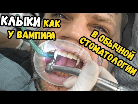 Видео: Делаю клыки как у ВАМПИРА ! БОЛЬНО ? сколько стоит ?