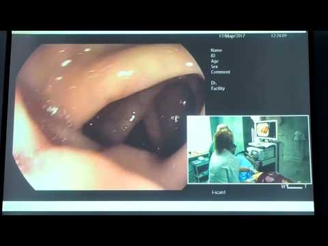 Видео: 15Live Веселов ВВ Трудная Колоноскопия PENTAX 7010 Фортранс