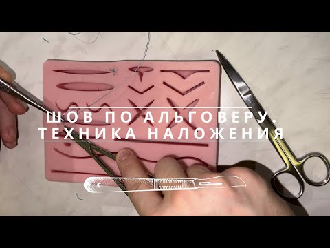 Видео: Шов по Альговеру. Техника наложения.