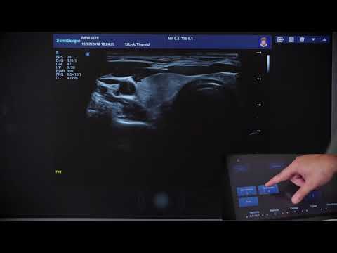 Видео: S40Exp 2 Основные параметры сканирования