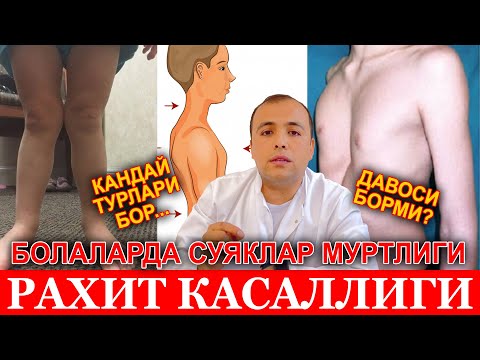 Видео: РАХИТ КАСАЛЛИГИ ВА УНИНГ ТУРЛАРИ ДАВОСИ БОРМИ...