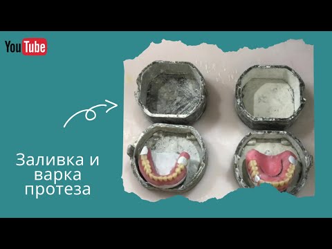 Видео: Заливка и варка зубного протеза. Этап 3