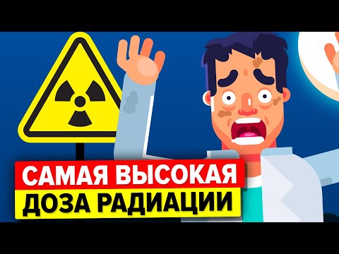 Видео: Человек получил передозировку радиационного излучения – вот что с ним стало.