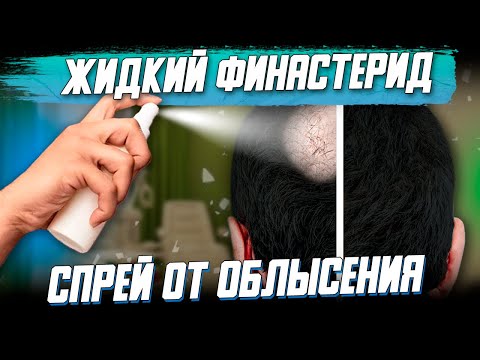 Видео: МЕСТНЫЙ ФИНАСТЕРИД и  ТОПИЧЕСКИЕ АНТИАНДРОГЕНЫ