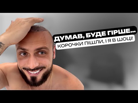 Видео: 9 день після пересадки волосся | Змиваю корочки та показую результат 🔥ШОК!