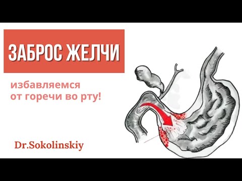 Видео: Заброс желчи в желудок: как избежать неприятностей с рефлюксом и ГЭРБ?