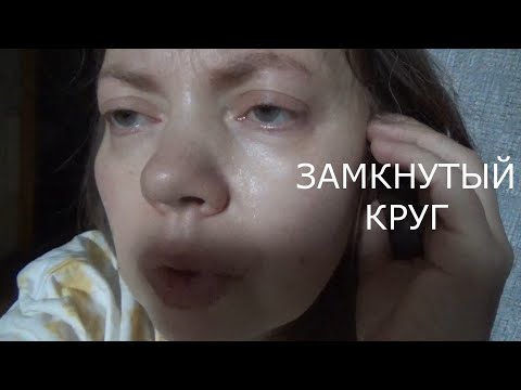Видео: плохие Анализы надо к Онкологу Замкнутый Круг