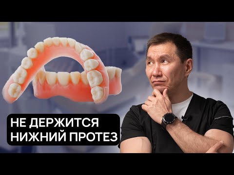 Видео: НЕ ДЕРЖИТСЯ НИЖНИЙ полный ПРОТЕЗ! Что делать? Расскажем как сделать так, чтобы он не выпадал