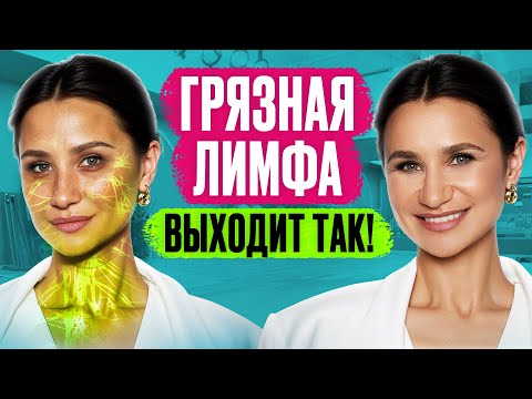 Видео: После ЭТОГО лимфа побежит как сумасшедшая, уйдут отеки, лишний вес, дряблость