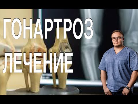 Видео: ЛФК при ГОНАРТРОЗЕ | Лечение Коленного Сустава