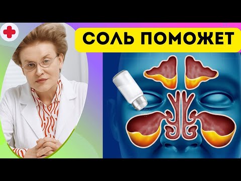Видео: Слизь в горле? ПОПРОБУЙТЕ ЭТОТ ПРОСТОЙ ХИТРОС С СОЛЬЮ! 🧂3 простых способа