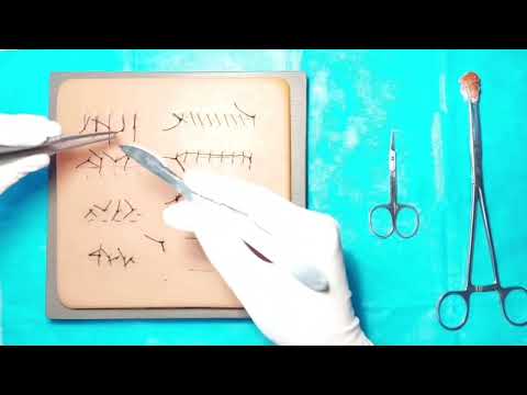 Видео: Як зняти хірургічні шви зі шкіри