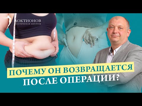 Видео: Что делать, если после абдоминопластики опять появился живот? Как сделать плоский живот?