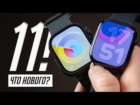 Видео: Долго с Apple Watch 11 — вот теперь хорошо? Обзор и опыт использования. Отзыв!