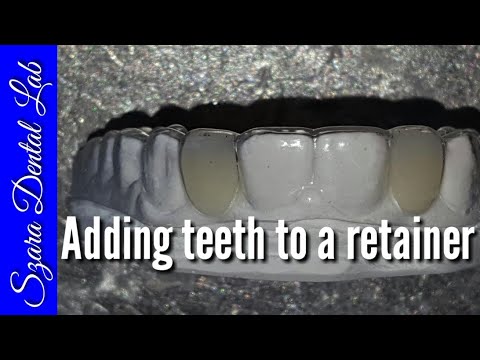 Видео: Как добавить зубы к прозрачному ретейнеру