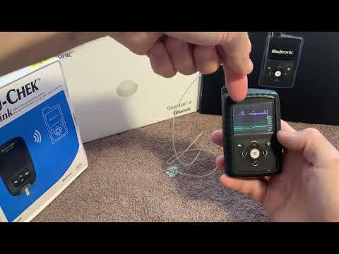 Видео: Medtronic 780g, 10 дней пользования. SmartGuard.