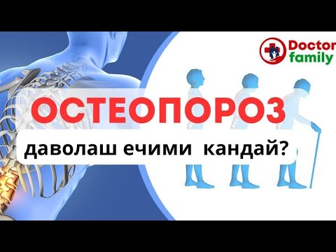 Видео: Остеопороз даволаш ечими кандай? #артрит #коксартроз #ревматизм