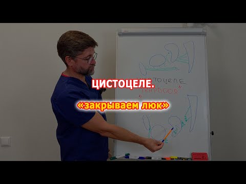 Видео: Цистоцеле и TrapDoor. Советы молодым хирургам.