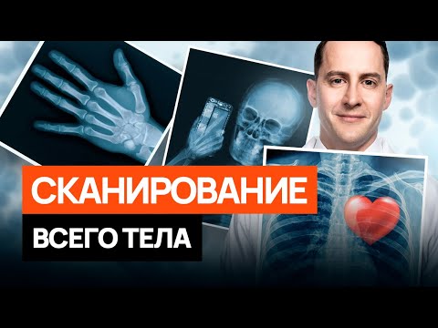 Видео: Один анализ на все виды рака! ЗА и ПРОТИВ полного сканирования тела. #онкология #диагностика #рак