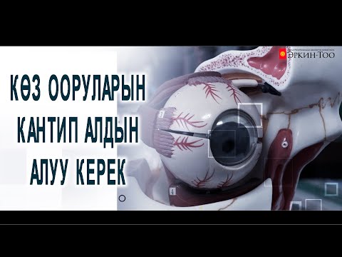 Видео: Кыргызстанда көз оорулары көбөйдүбү?