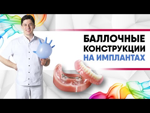 Видео: Съёмный протез на имплантах с баллочной системой фиксации [ покрывные зубные протезы на балке ].
