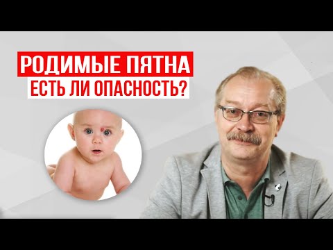 Видео: Как относиться к РОДИМЫМ ПЯТНАМ у детей? Советы доктора