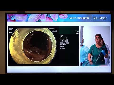 Видео: 31 Fujifilm Cad Eye Искусственный Интеллект 1 Малихова ОА Демонстрация работы